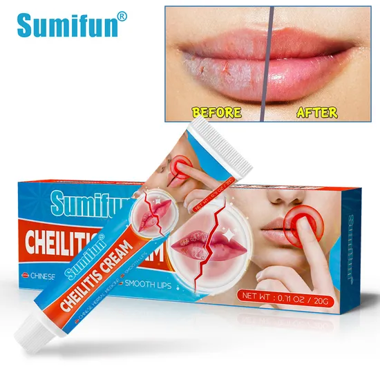 Cheilitis Cream Inflammation Labial Herpes Antibacterial Ointment Chapped Lips Wrinkles Rehydration