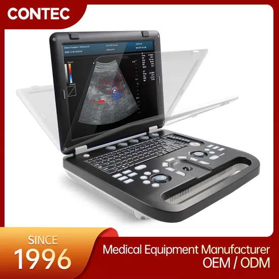 Contec Cms1700c High Quality Diagnostic Ultrasonic Scanner Machine Color Doppler Ultrasound