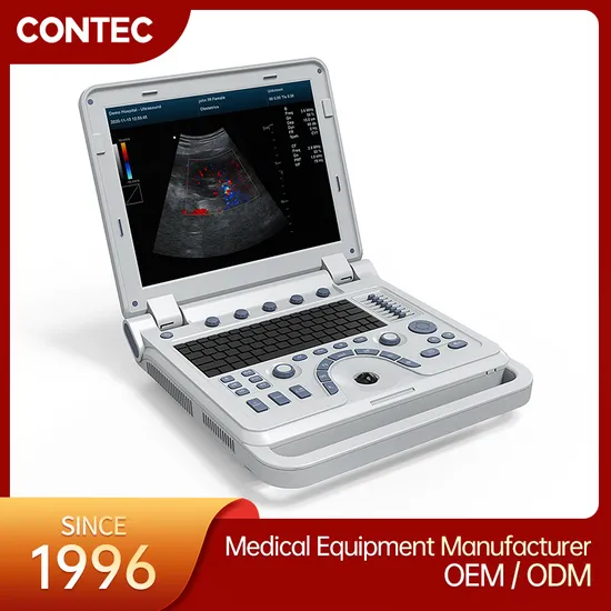 Advanced Contec Cms1700b Portable Color Doppler Ultrasound Scanner