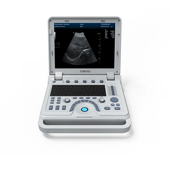 Contec Medical Ultrasonic Scanner Color Doppler Ultrasound Machine