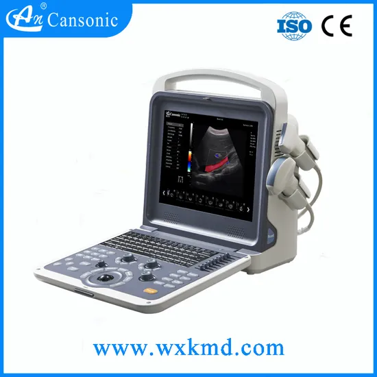 Portable Color Doppler Ultrasound Scanner (K2)