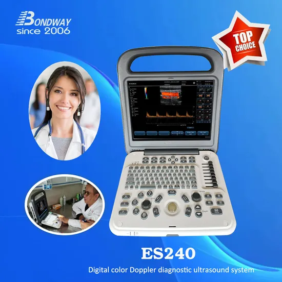 Factory Low Price Full Digital Portable Color Doppler Diagnostic Ultrasound Imaging System, with 12-1 Inch High-Resolution LCD, Medical Ultrasonic Machine