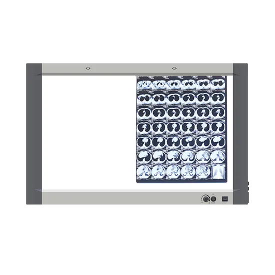 Mg-02X Portable X-ray Machine Duplex Film Viewer Hot Sale