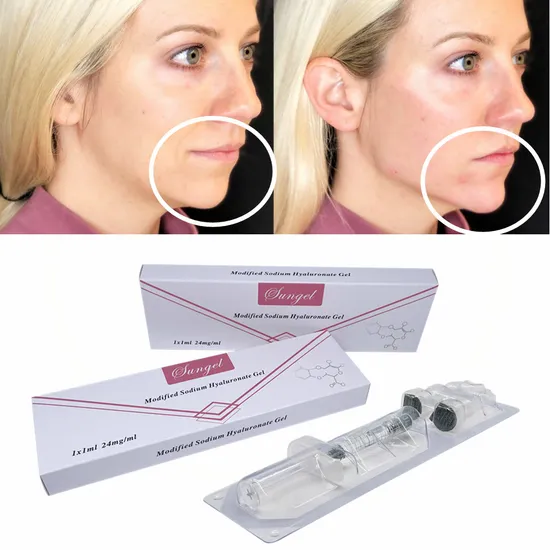 CE 24mg Sungel Mono Phasic Deep Lidocaine Dermal Filler Injection Hyaluronic Acid for Plastic Surgery Implants