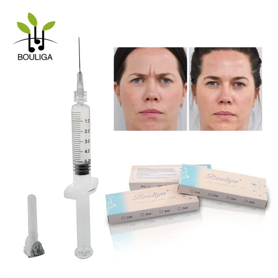 OEM 5ml Crosslinked Hyaluronic Acid Lips Filler