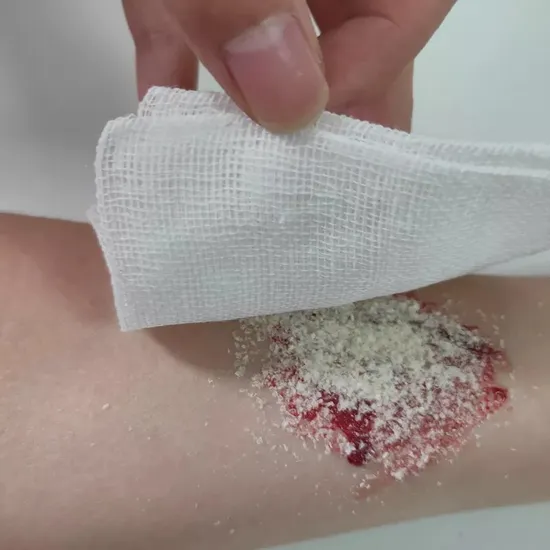 Absorbable Hemostatic Particles Celox Hemostatic Granules Carboxymethyl Chitosan Hemostatic Agent Powder Granule for Trauma