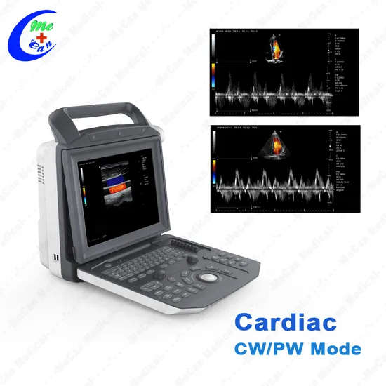 Full Digital Portable Mobile Echocardiography Cardiac Echo Ultrasound Scan Portable Color Doppler Ultrasound Machine for Pregnancy
