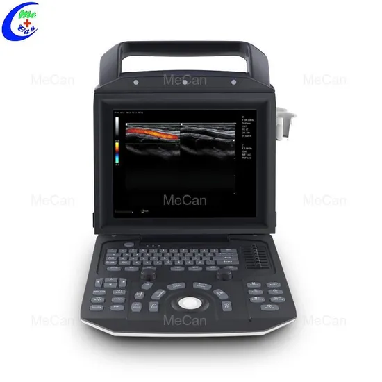 Guangzhou Factory High Quality Portable 4D Color Doppler Ultrasound Machine with Probes for Clinic