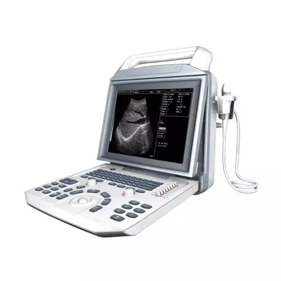 Best Price Full Digital Medical Veterinary Ultrasonic Equipment B/W Portable Ultrasound Machine