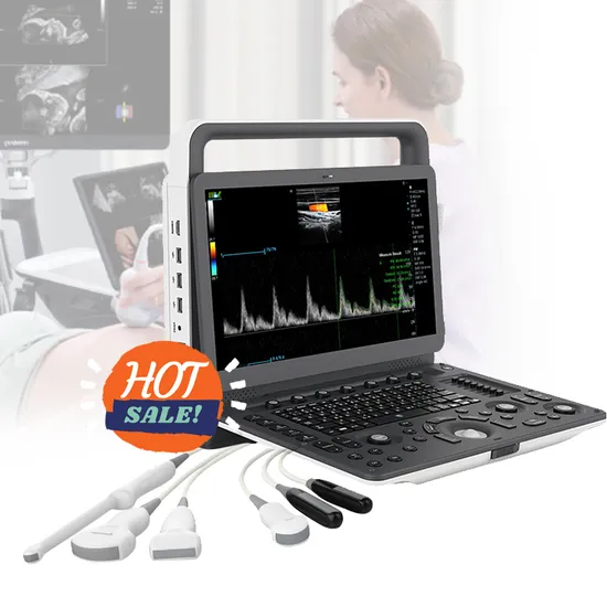 Medical Color Doppler Ultrasonic System Laptop Ultrasound Machine Portable 4D Cardiac Ultrasound Scanner