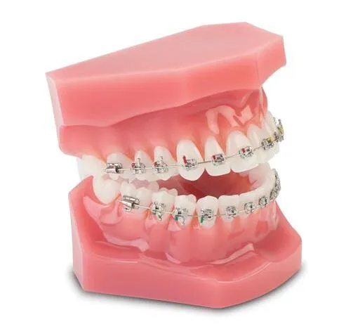 Orthodontic Training Standard Braces Demo Model