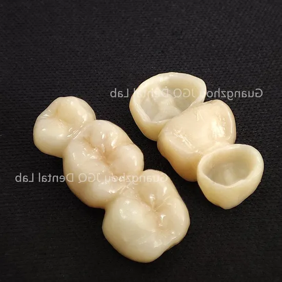 Multi-Layered Solid Full Contour Zirconia Crown Bridge China Digital Lab Dental Suppliers Best Price