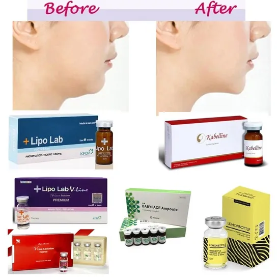 Fat Dissolve Solution Kabelline 5vails*8ml Slimming Lipolysis Injection Lose Weight Chin, Face and Body Lipolab Dr. Lipo+ Belkyra Cellofill V Babyface