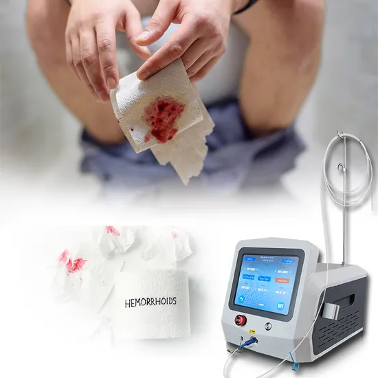 2024 Hot Sale Proctology Laser Piles Surgery Hemorrhoids Fissure Fistula Pilonidal Sinuns Surgery Hemorrhoids Diode Laser Machine 980nm 1470nm
