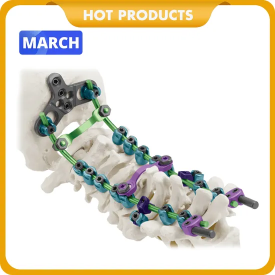 Cervical Spine Screw Spinal Pedicle Screw Box Spinal Polyaxial Pedicle Orthopedic Pedicle Spine Screw
