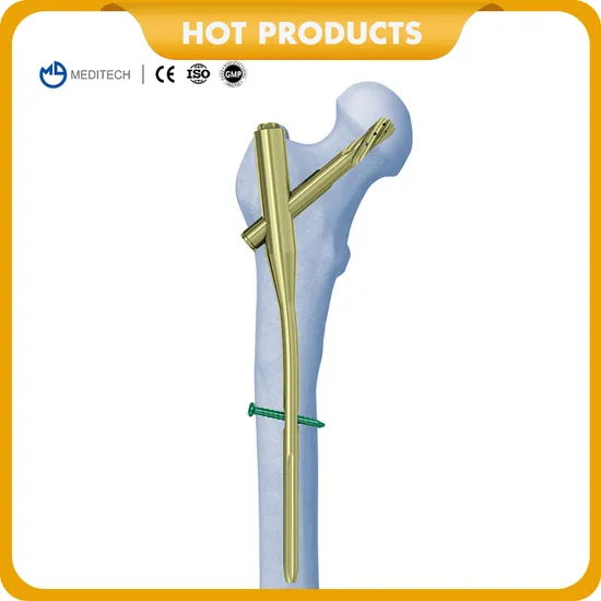 Titanium Medical Orthopedic Implant Pfna (Gama) Femoral Interlocking Intramedullary Nail