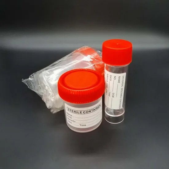 30ml, 60ml, 120ml Urine Container Stool Container Specimen Container