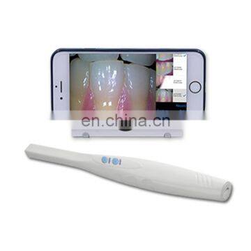 Dental Intra Oral Camera Dental Endoscope Dental Loupe Camera / Dental Wifi Intraoral Camera / Homeuse Fashion White 1 Set