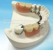 Anterior PFZ And Posterior Crowns Zirconia Accepting International Dental