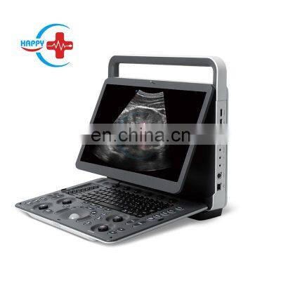 Original Sonoscape E2V ultrasound device for pet clinic vet use portable color doppler ultrasound Veterinary Sonoscape E2V