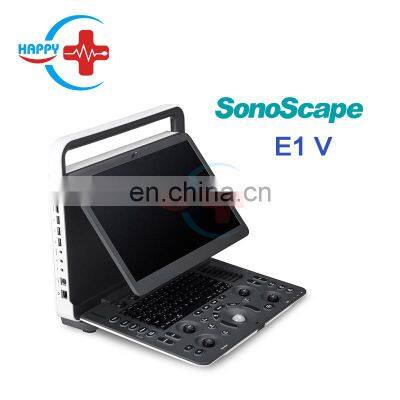 E1V sonoscape ultrasound portable veterinary ultrasound scanner