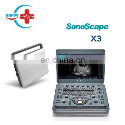 Brand new hospital factory price Portable ultrasound /Sonoscape x3 /Usb ultrasound scanner