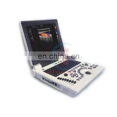 HC-A013C Color Doppler UItrasound color doppler ultrasound machine Color Doppler UItrasound Diagnostic System