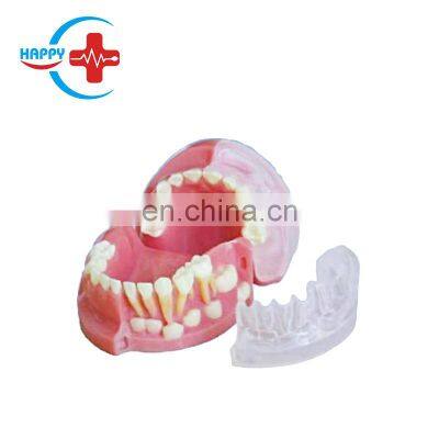 HC-S421 Dental Tooth Model Three-year-old child Alternation of Deciduous Teeth and Permanent Teeth Model